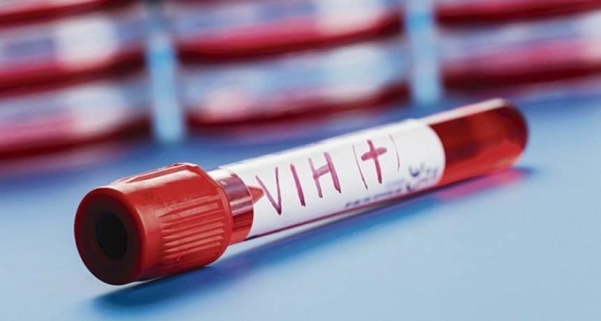 "Por prejuicios, el VIH sigue siendo un estigma"